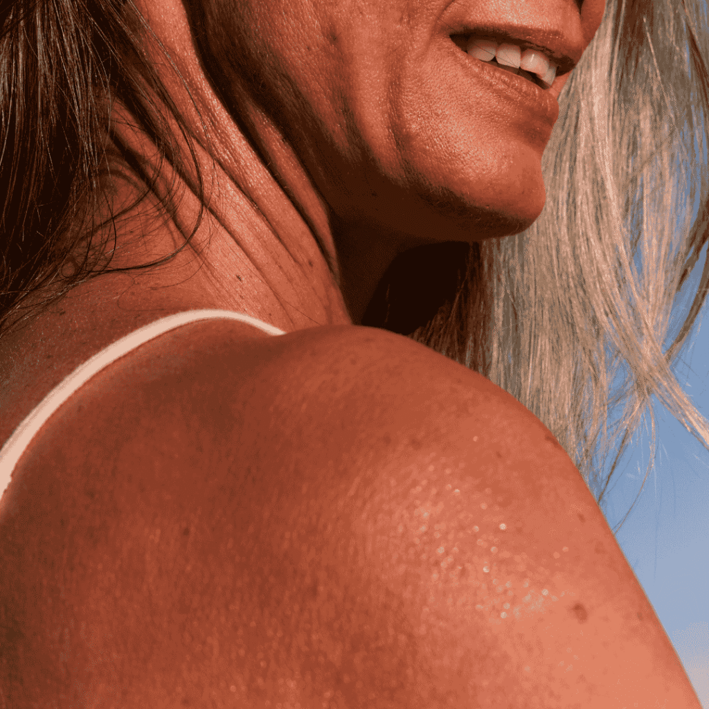 Dull Skin