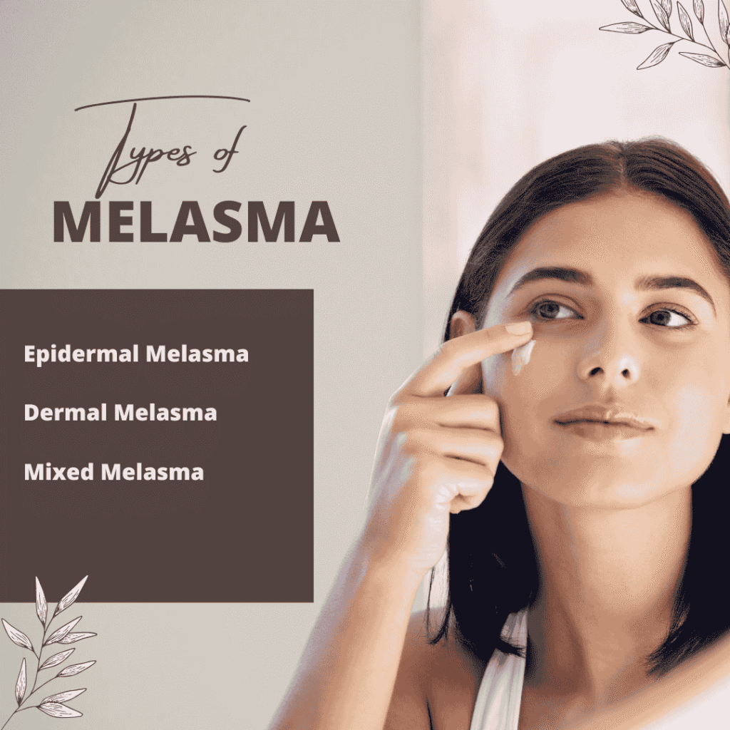 Melasma