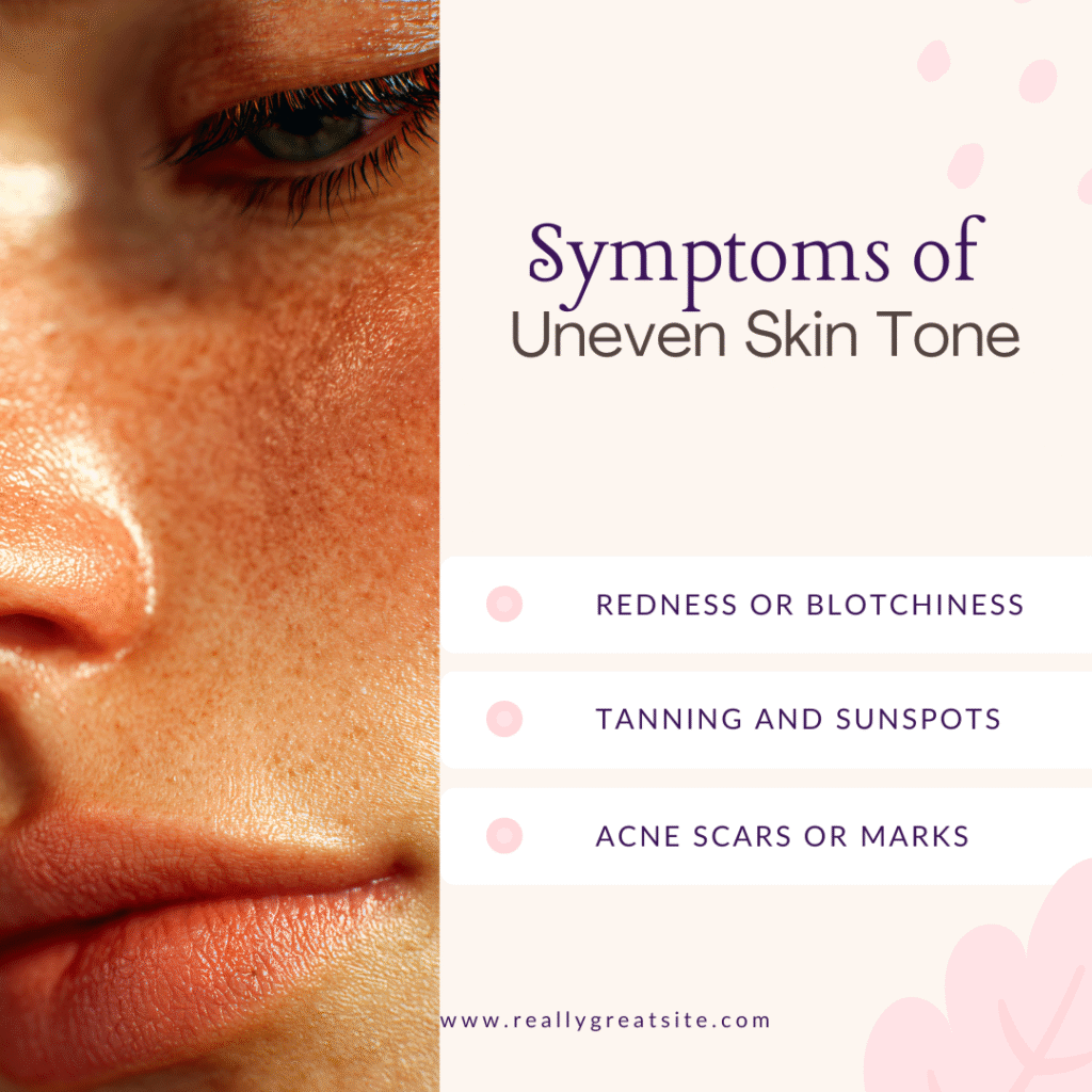 Uneven skin tone