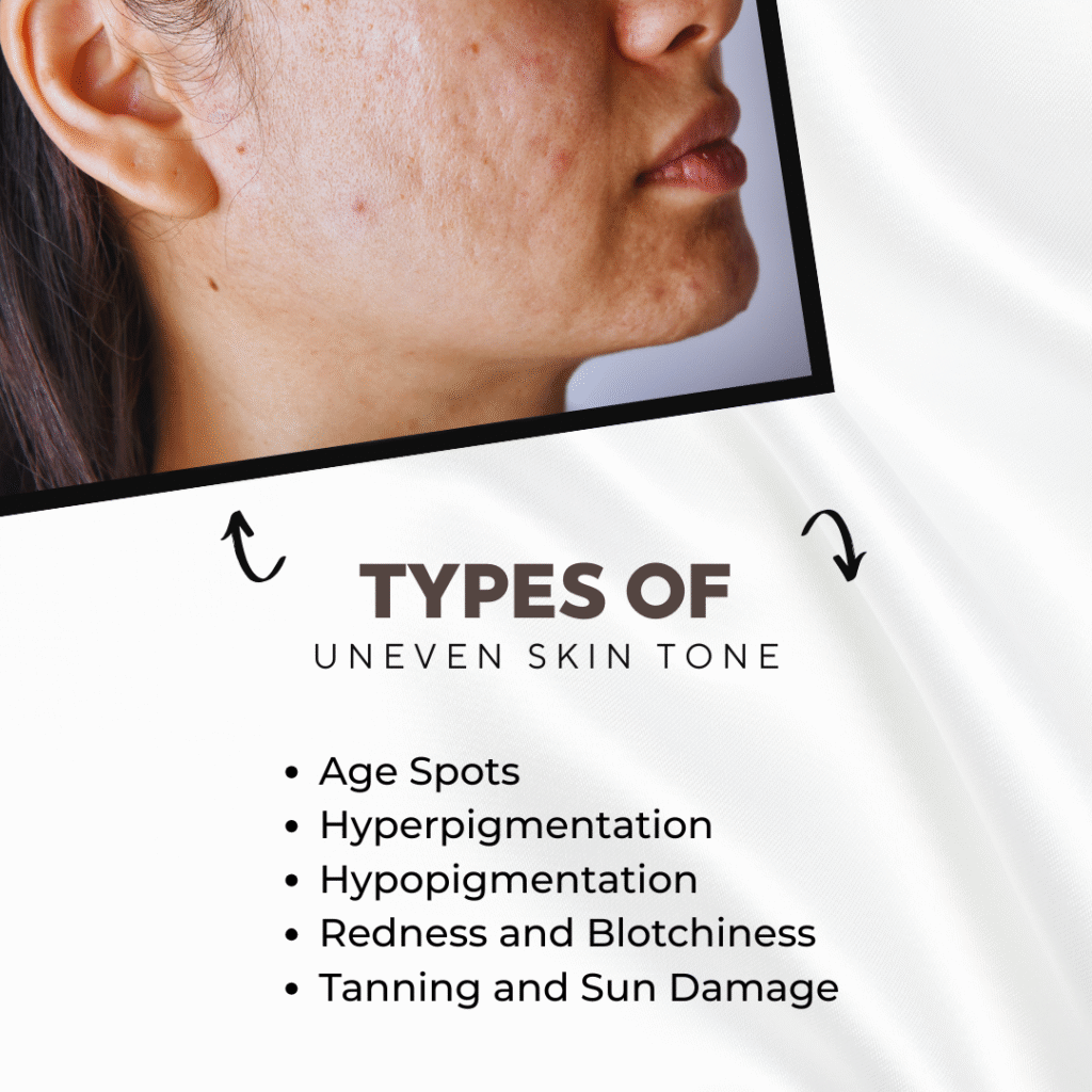 Uneven skin tone