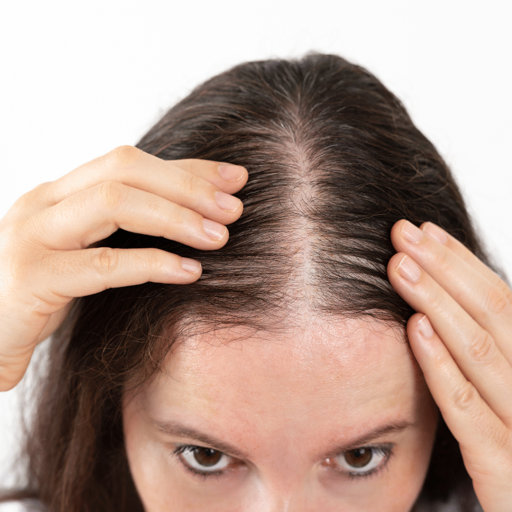 female Hair loss treatment