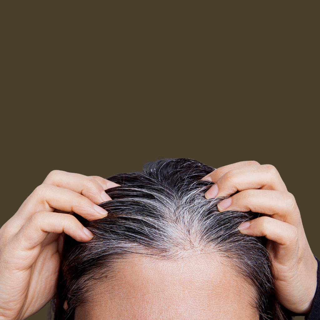 Female hair loss treatment