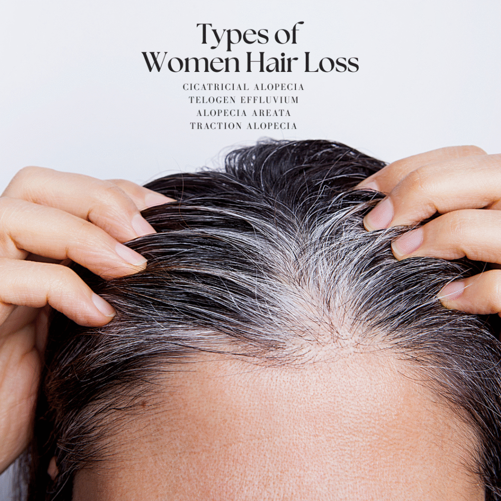 female Hair loss treatment