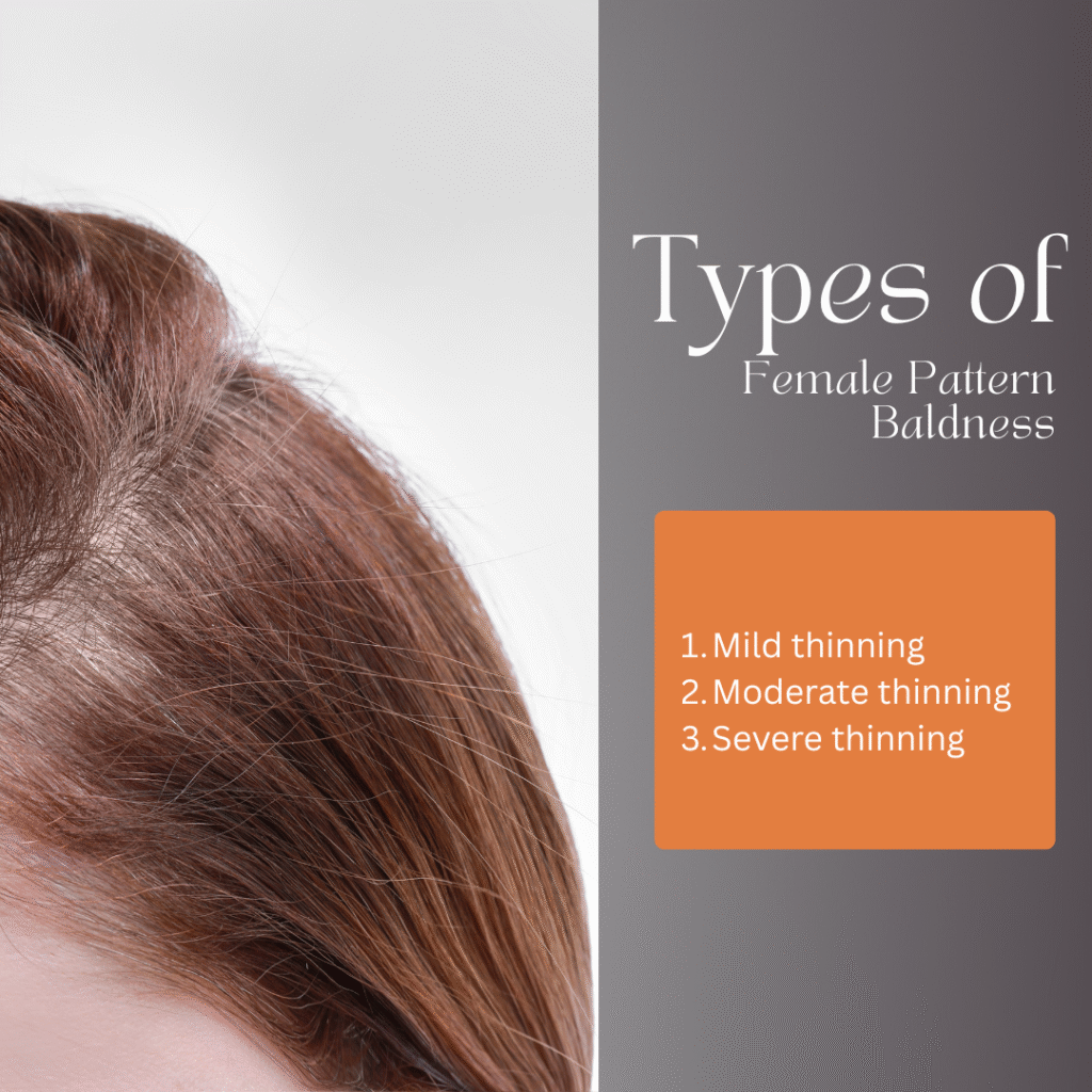 Female hair loss treatment