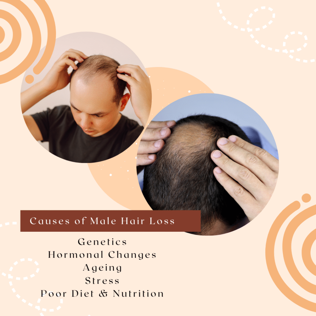 Male hair loss treatment