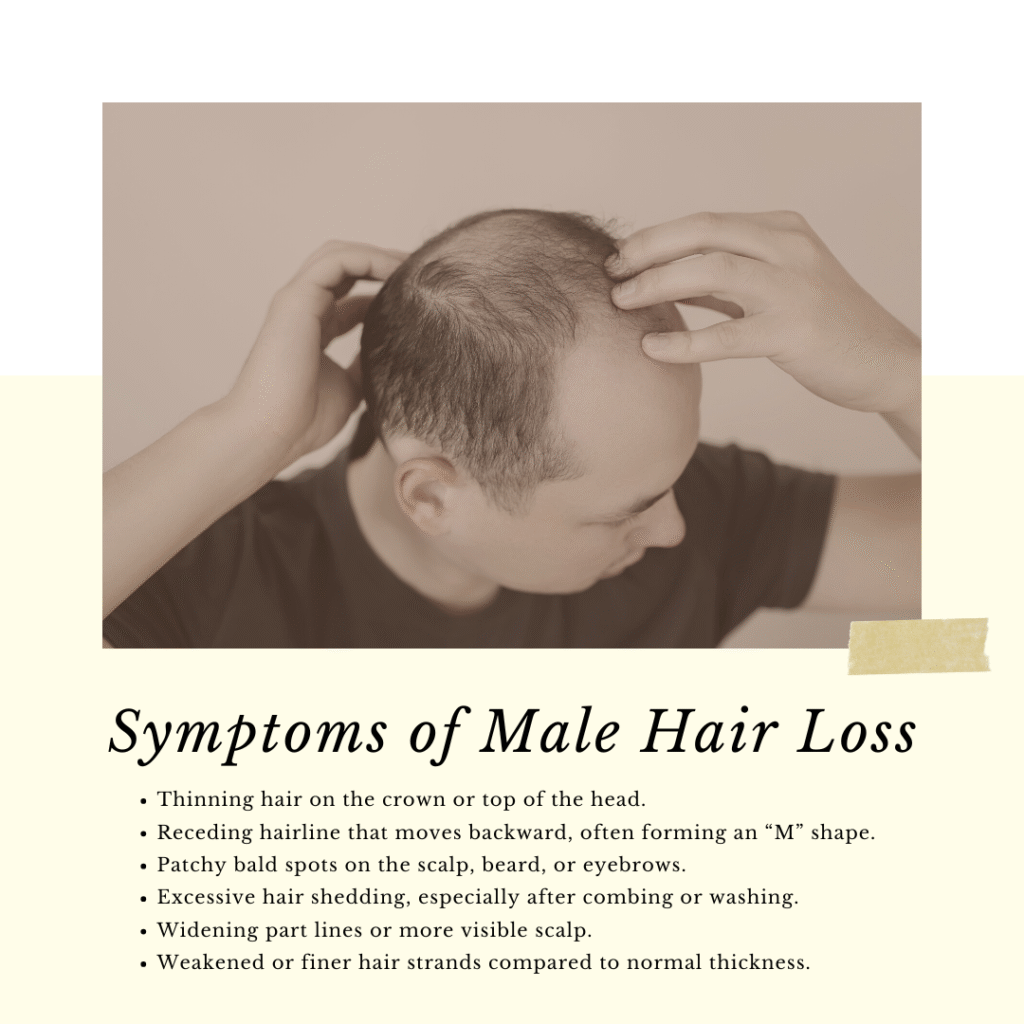 Male hair loss treatment