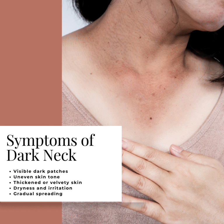 Dark Neck Causes, Symptoms & Treatment