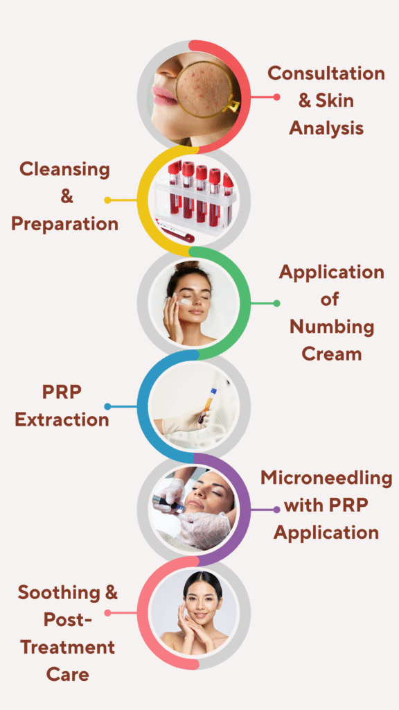 Microneedling PRP