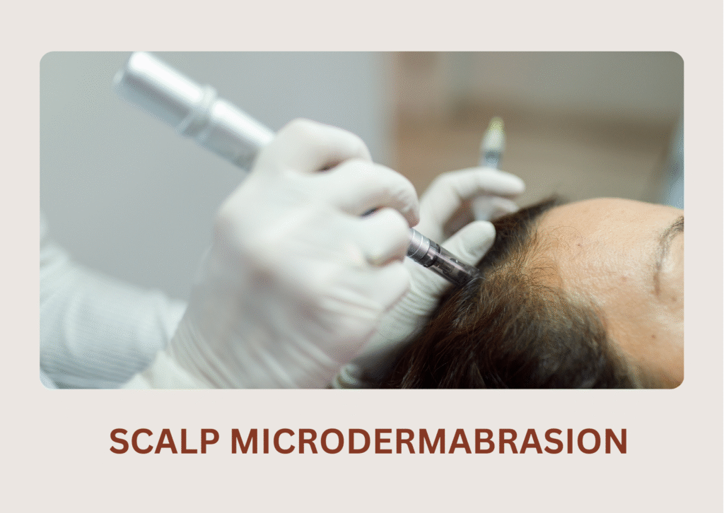 Scalp Microdermabrasion