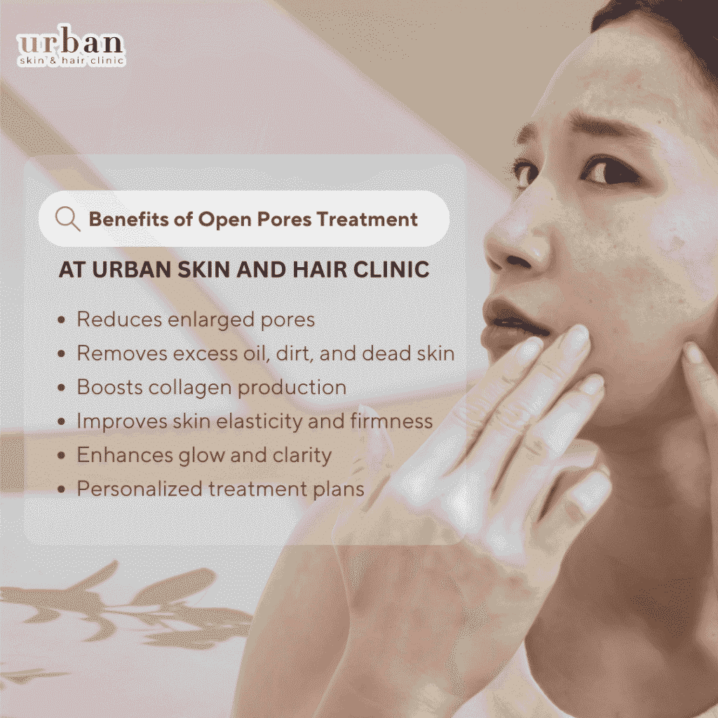 open pores treatment benefit