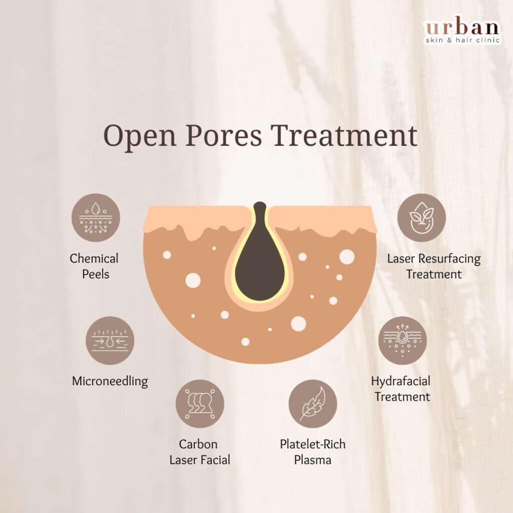 open pores treatments