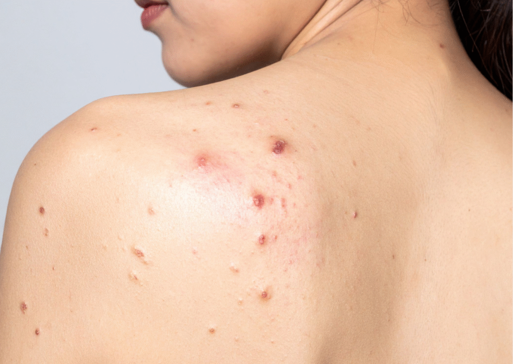 Urban website treatment