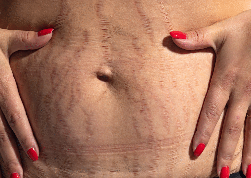 Urban website treatment 26