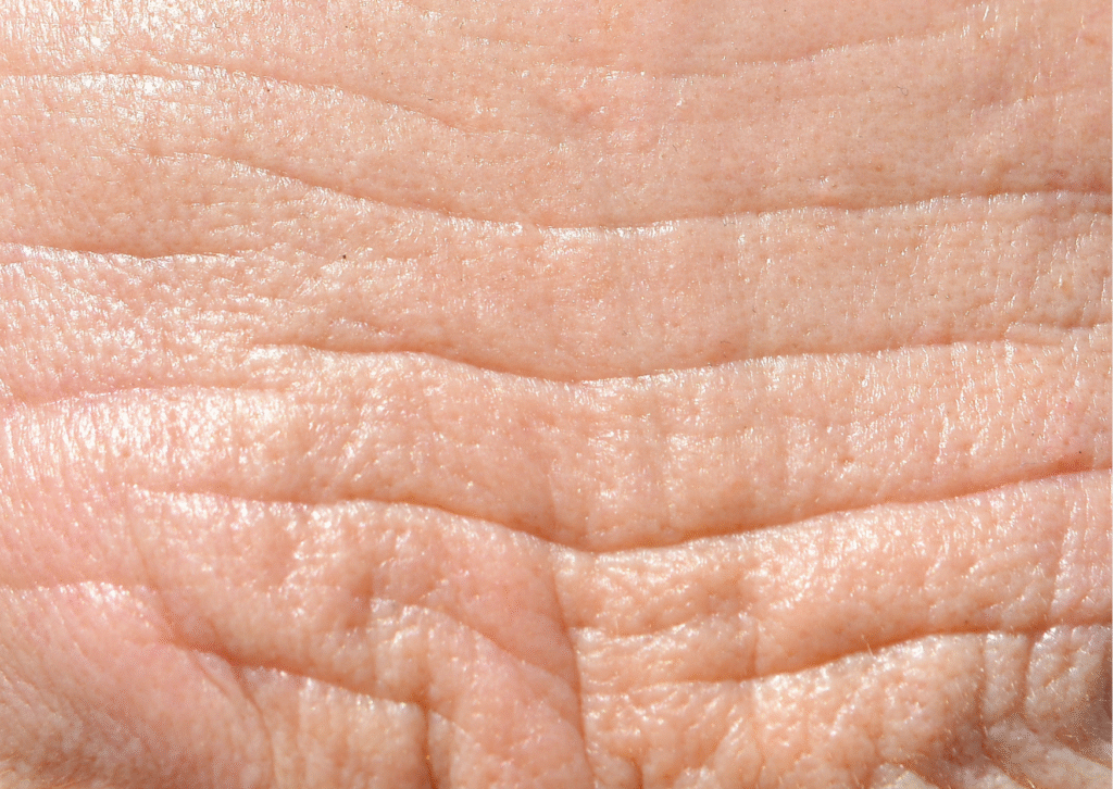 Urban website treatment 28