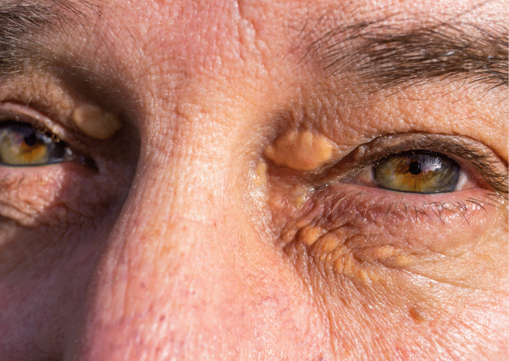 Urban website treatment 30