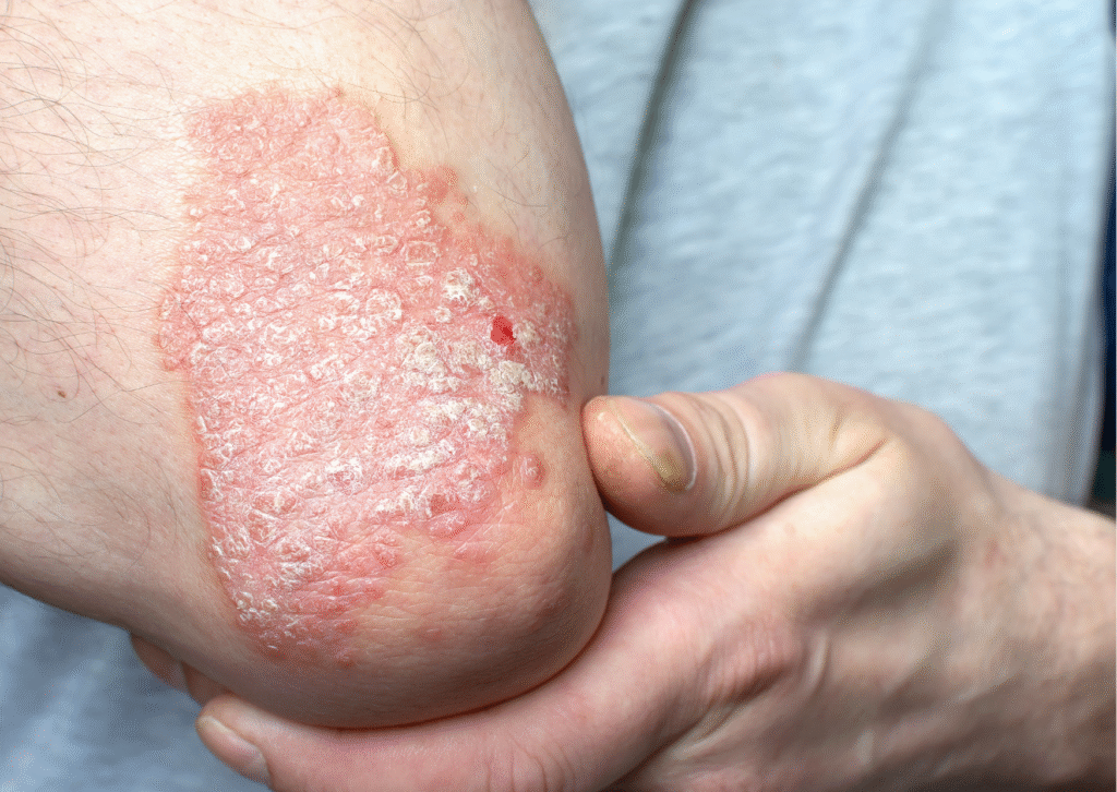 Urban website treatment 38