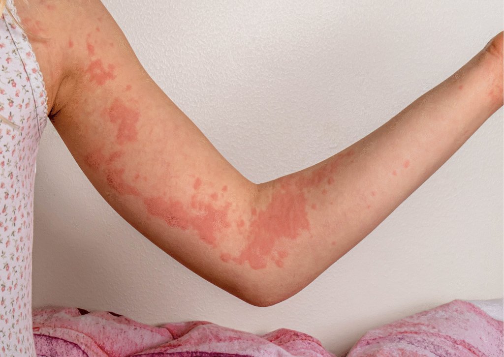 Urban website treatment 39