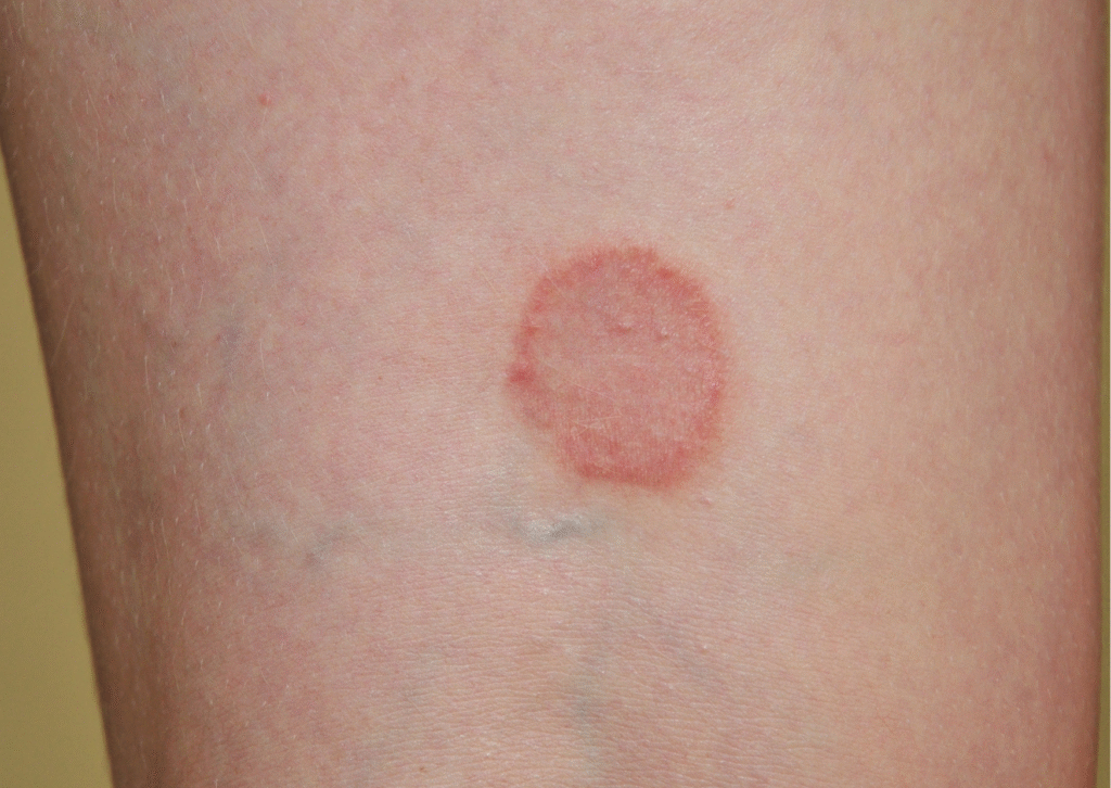 Urban website treatment 42