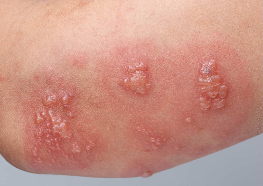 Urban website treatment 43