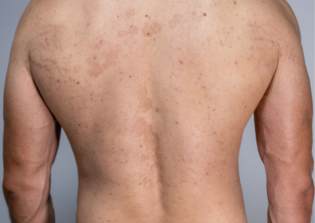 Urban website treatment 47