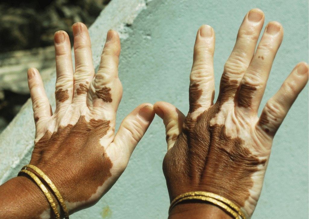 Urban website treatment 5