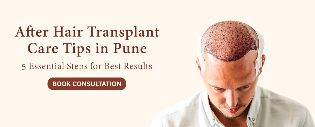 After Hair Transplant Care Tips
