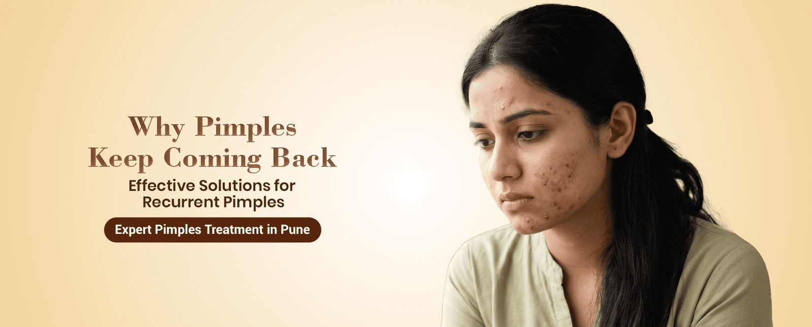 Homes 41 Pimple Treatment in Pune