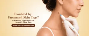 Skin Tag Removal Treatment in Pune – Safe & Effective Skin Tag Removal by Dermatologists