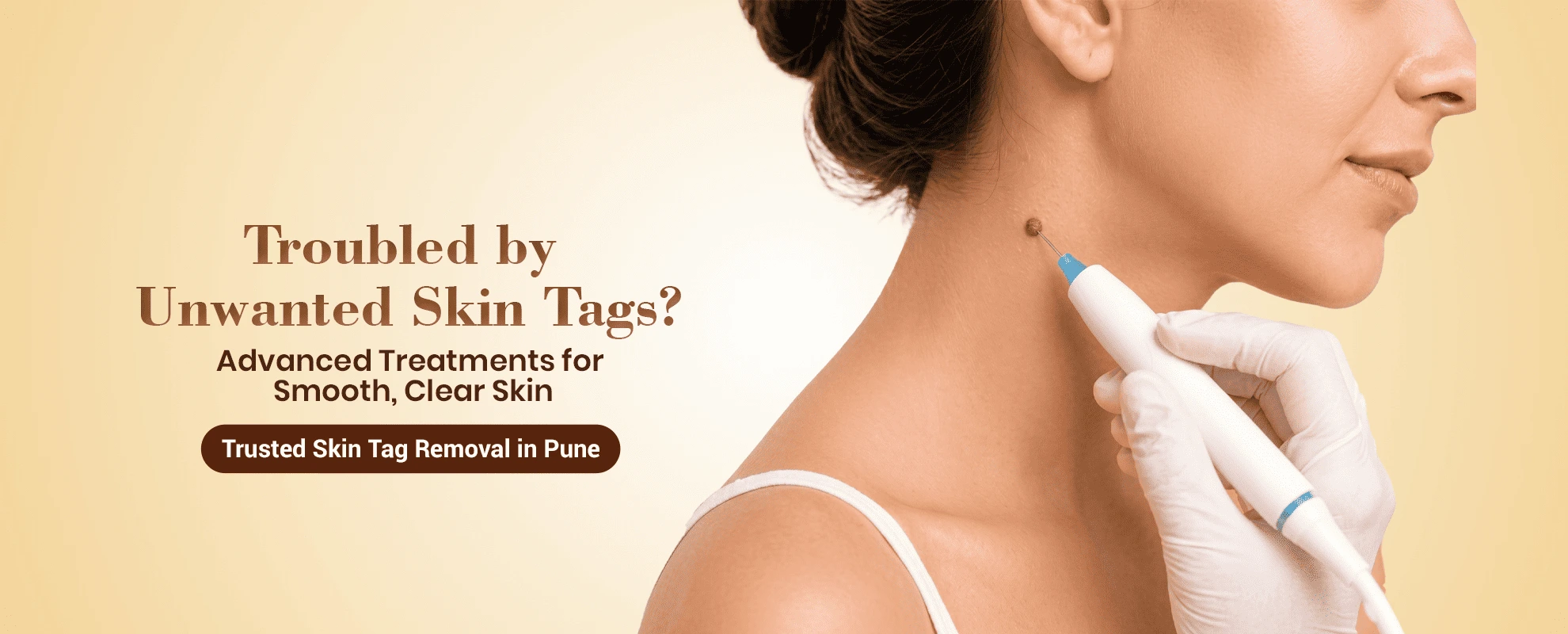Home 47 Skin Tag Removal Treatment in Pune – Safe & Effective Skin Tag Removal by Dermatologists
